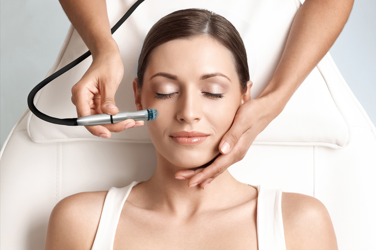 Tratamiento Microdermoabrasión Punta de Diamante - Pack 5 Sesiones